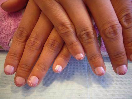 チビツメだって...