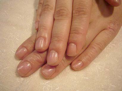 自ツメ補強に...