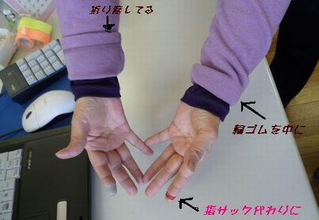 輪ゴムの利用法♪