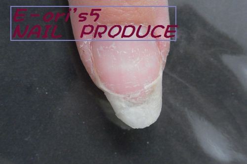 自爪に亀裂が入っても大丈夫です。