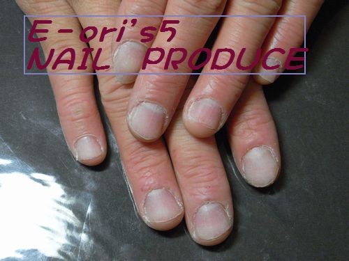 深爪を育てていきましょう。