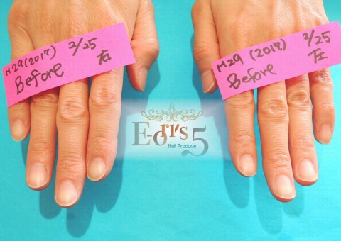 ケアは美しさの基本です。