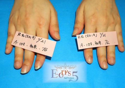 オニコファジー(噛爪症)の育成。～A-102様・初めての来店～