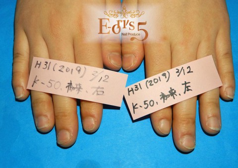 折れやすいお爪の育成。~K-50様・初めての来店~