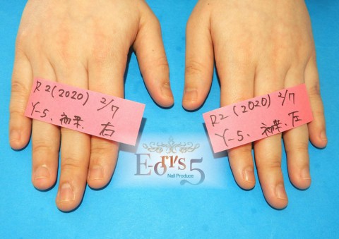 オニコファジー(噛爪症)の育成。~Y-5様・初来店~