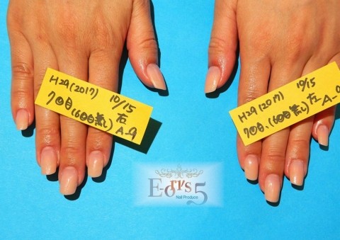 オニコファジー(噛爪症)の育成。～A-9様・6回目のお直し～