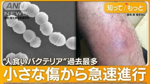 指先に傷がある方、要注意!