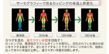 カッピングも合わせると最高315