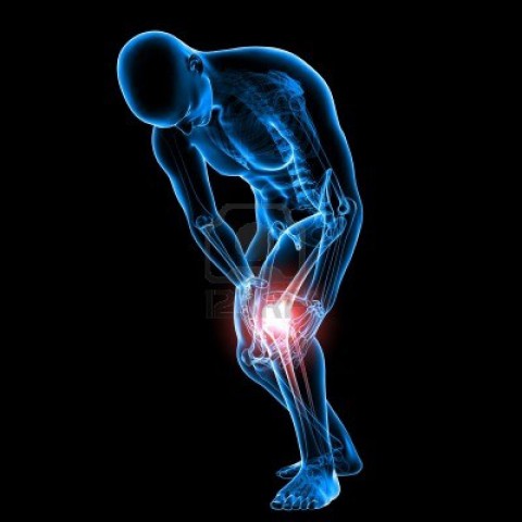 膝の関節炎、変形性膝関節症