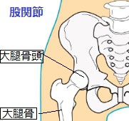 股関節痛